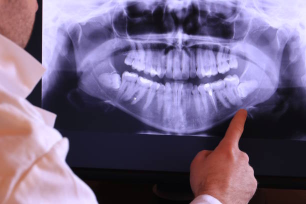 Best Weekend Emergency Dentist in Fort Washakie, WY