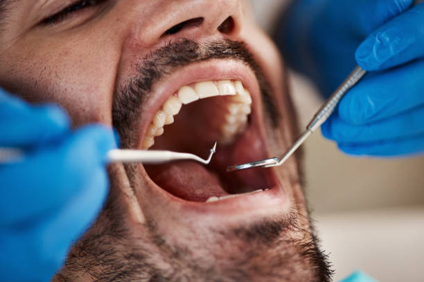 Best Pediatric Emergency Dentist in Fort Washakie, WY
