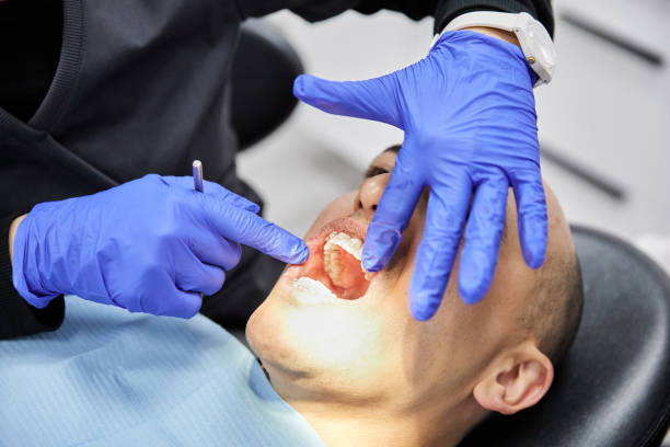 Best Emergency Wisdom Teeth Removal in Fort Washakie, WY